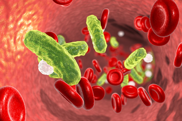 Ilustração 3D mostrando bactérias em forma de haste no sangue com glóbulos vermelhos e leucócitos, em alusão à sepse. 