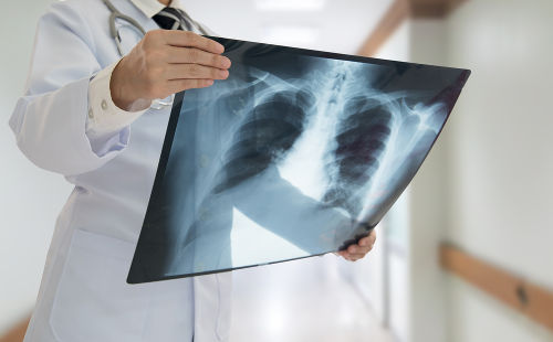 A radiografia, ou exame de raio X, é um exemplo de como a radiação eletromagnética pode ser empregada na Medicina
