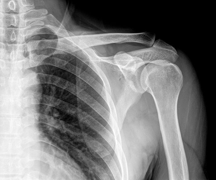 Os raios X são absorvidos pelos ossos, por isso é possível produzirmos imagens do interior do corpo humano.